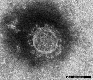 【新型コロナウイルス研究Part④】普通の風邪じゃない！明らかになってきた感染症の実態