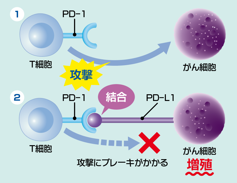 ノーベル医学 生理学賞 本庶 佑先生の研究 がん細胞が免疫の攻撃を回避するしくみを解明 コカネット
