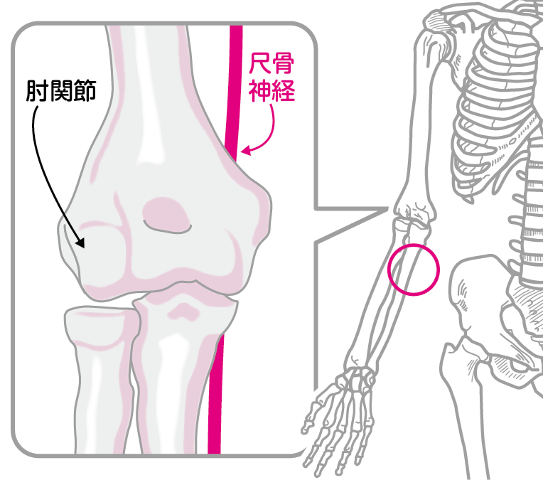 ひじを打ったとき たまにしびれるのはなぜ コカネット