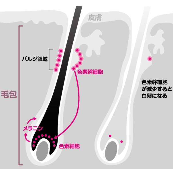 白髪になるのはなぜ コカネット