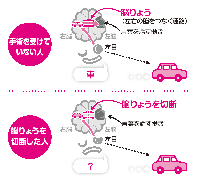 脳はどうして左脳と右脳に分かれているの？│コカネット